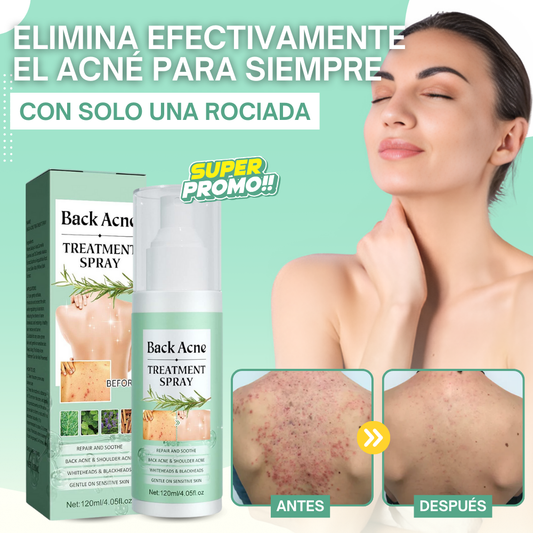 BACKACNE® | EL MEJOR PRODUCTO NO INVASIVO PARA TU SALUD QUE ELIMINA EL ACNE Y LOS PUNTOS NEGROS DE CARA Y CUERPO SIN DEJAR RASTRO