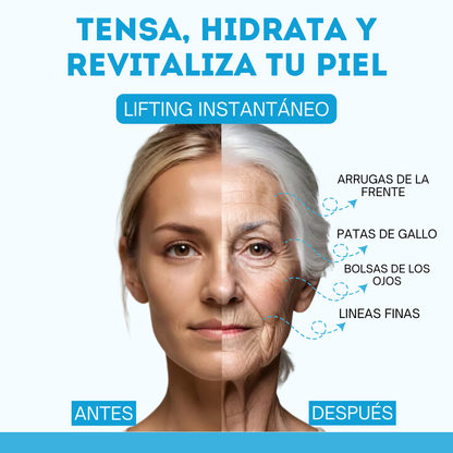 AGELESS B5 ® EL ÚNICO SERÚM CON EFECTO BOTOX AVALADO POR LA ORGANIZACIÓN MUNDIAL DE LA SALUD QUE ELIMINA LAS ARRUGAS, LINEAS DE EXPRESIÓN Y PIEL FLÁCIDA EN MINUTOS